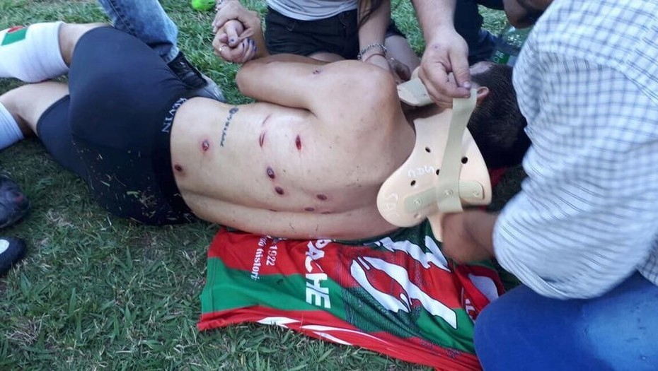 La policía de Santa Fe reprimió a jugadores de Sportivo Las Parejas con balas de goma | Deportes