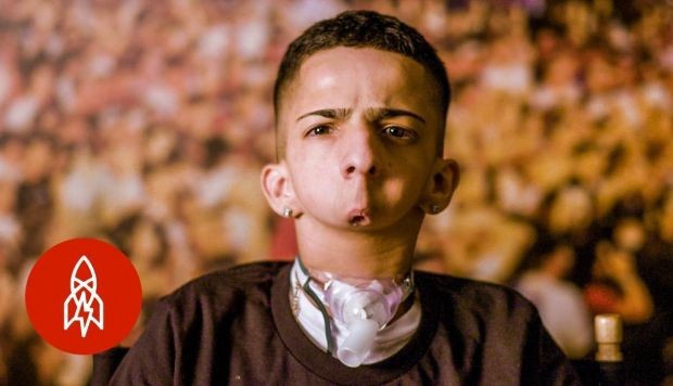 La historia del joven que nació sin mandíbula y triunfa como rapero | Curiosidades
