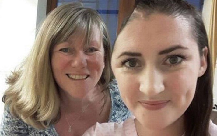 La increíble recuperación de la modelo que perdió un tercio del cráneo | Curiosidades