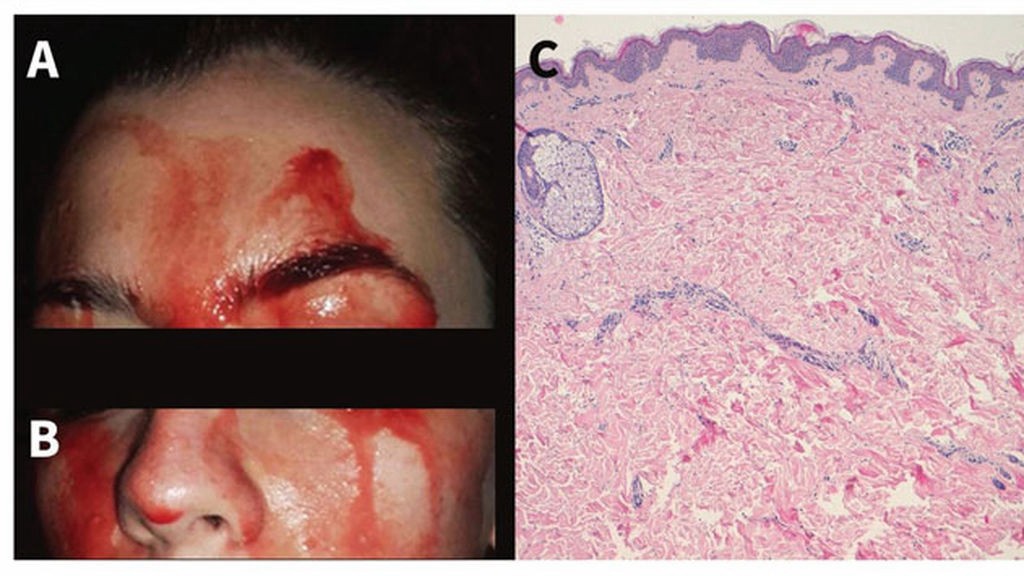 El extraño caso de la mujer que transpira sangre por las manos y la cara | Curiosidades