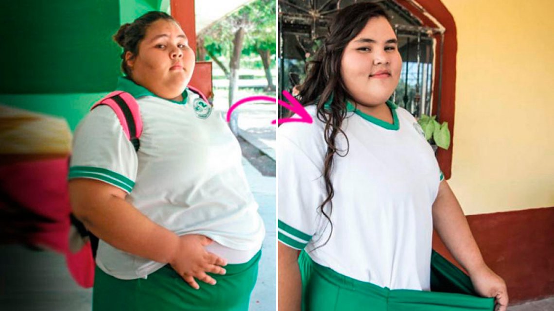 La chica que bajó 90 kilos para festejar su cumpleaños de 15 | Curiosidades
