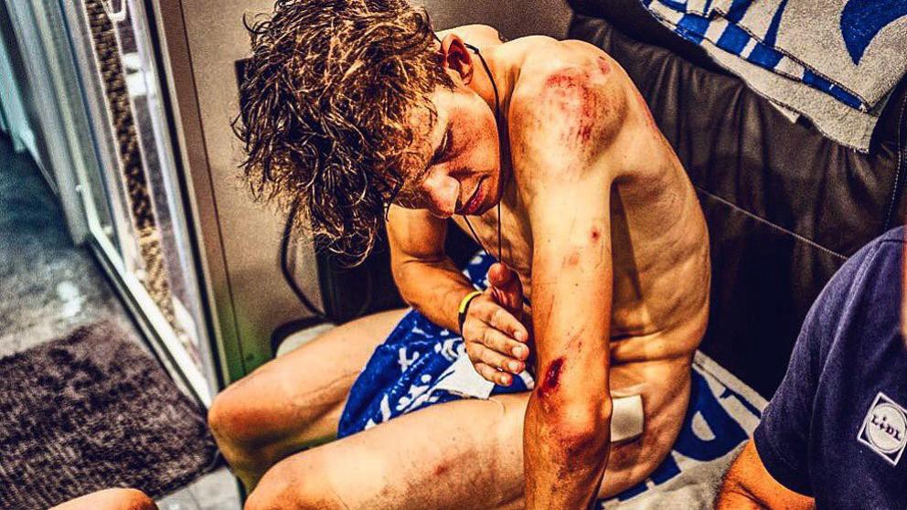 Así quedó un ciclista tras una dura etapa del Tour de Francia | Deportes