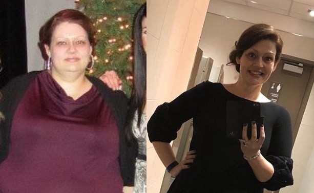 La mujer que adelgazó 70 kilos con sólo tres tips de su nutricionista | Curiosidades