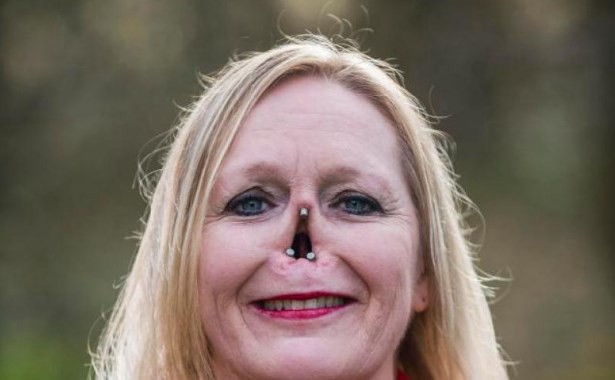 La prótesis magnética que ayuda a vivir a la mujer sin nariz | Curiosidades