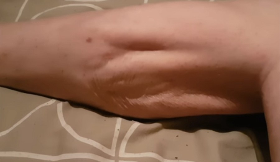 Video impresionante: así afecta un calambre a los músculos del cuerpo | Curiosidades