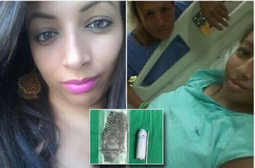 El testimonio de la brasileña que nació sin órganos reproductivos y se los reconstruyeron con piel de pescado | Curiosidades