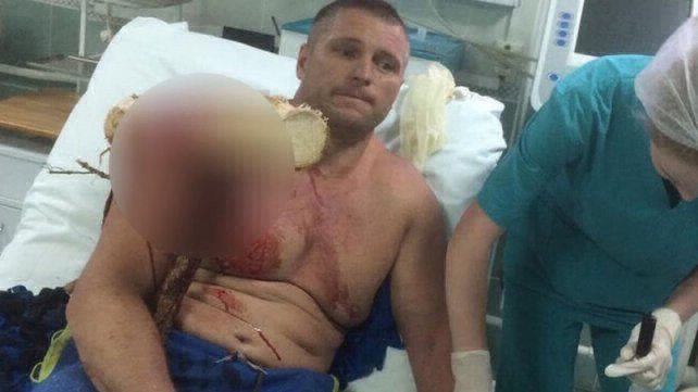 Estremecedor: cayó con su parapente y un tronco le atravesó el cuerpo | Curiosidades