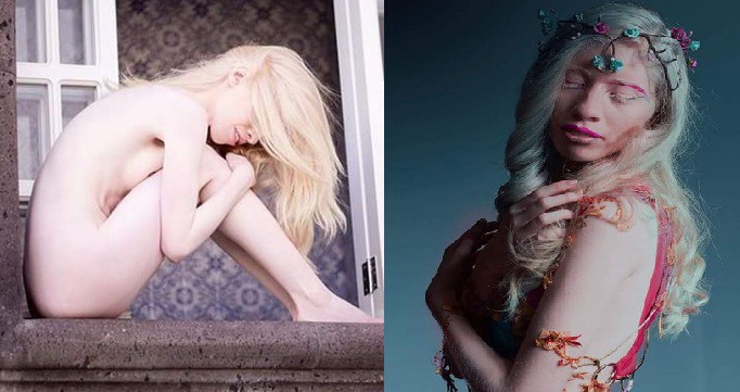 "Ser diferente es una bendición": la historia de la joven albina que se hizo modelo para enfrentar a la discriminación | Espectáculos