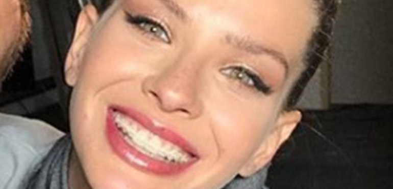 La sonrisa de la China Suárez sin brackets | Espectáculos