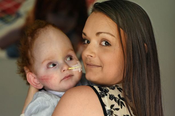 "Mamá": la primera palabra del nene que nació sin cerebro | Internacionales