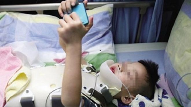 Cayó de un piso 18 y lo primero que pidió después de sobrevivir fue su celular | Internacionales