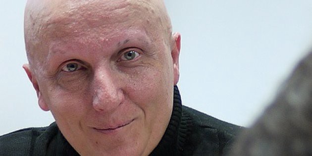 España: detuvieron a un hombre por estafa que pedía ayuda para tratarse 2.000 tumores | Internacionales