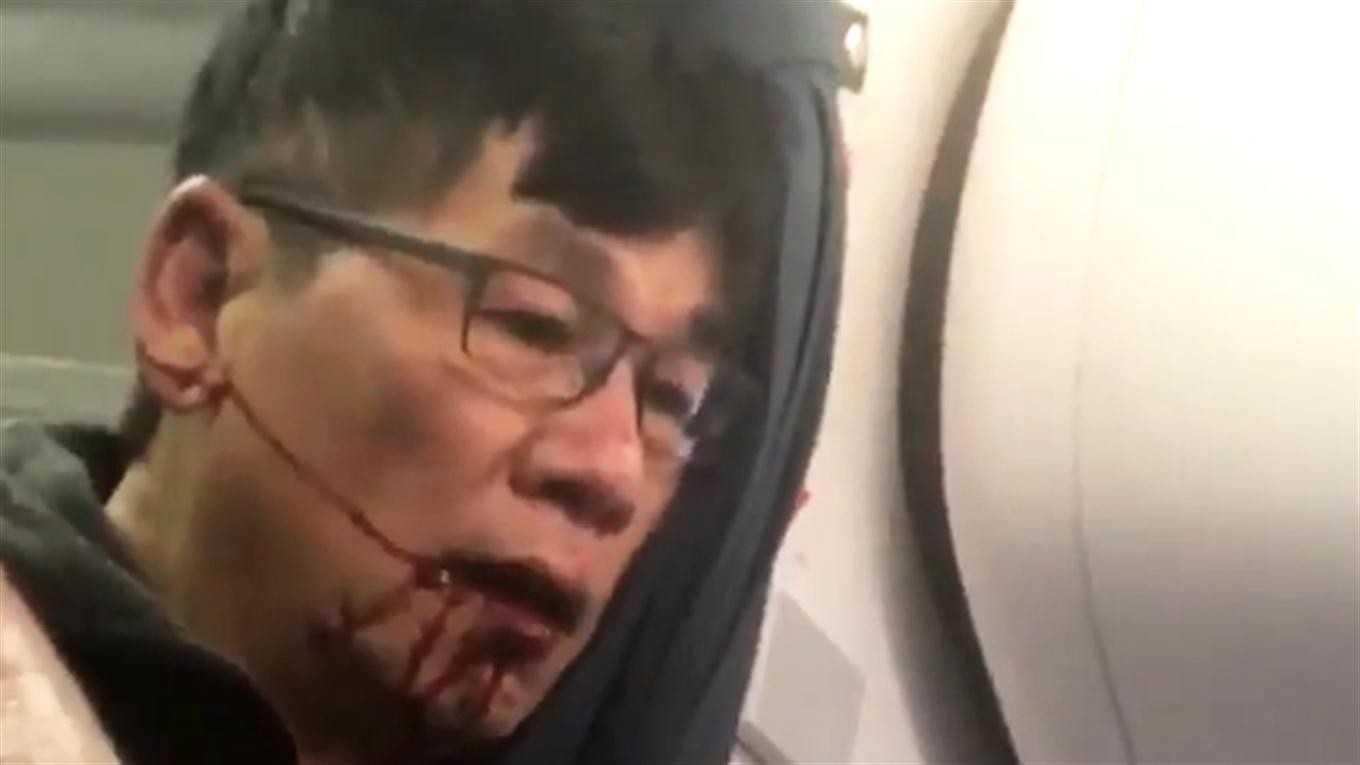 El pasajero que fue sacado del vuelo de United Airlines sufrió una conmoción cerebral | Internacionales