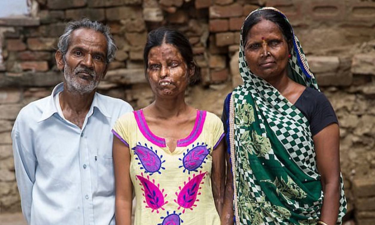 Una mujer volvió a vivir con su el hombre que le tiró ácido en la cara, dejó ciega a una de sus hijas y mató a la otra | Internacionales