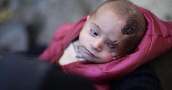 La historia de Karim, el bebé sirio que perdió un ojo y se convirtió en símbolo de la resistencia | Internacionales