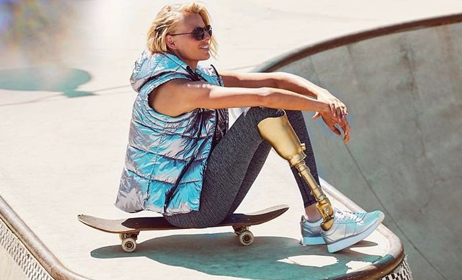 Una supermodelo perdió una pierna por un tampón y ahora podrían amputarle la otra | Internacionales