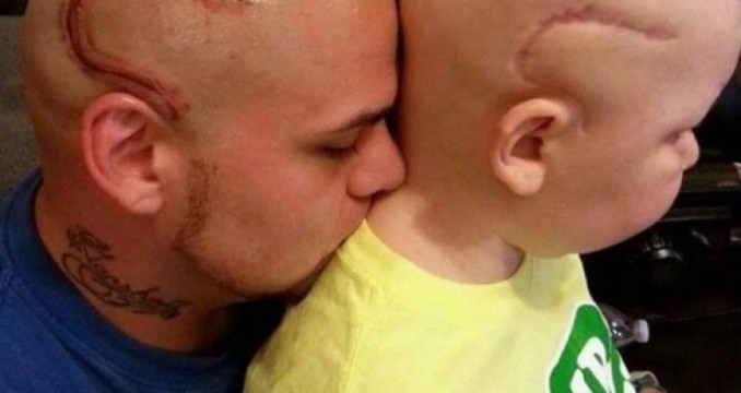 Murió el nene, cuyo papá se había tatuado en la cabeza una cicatriz para hacerlo sentir mejor | Internacionales