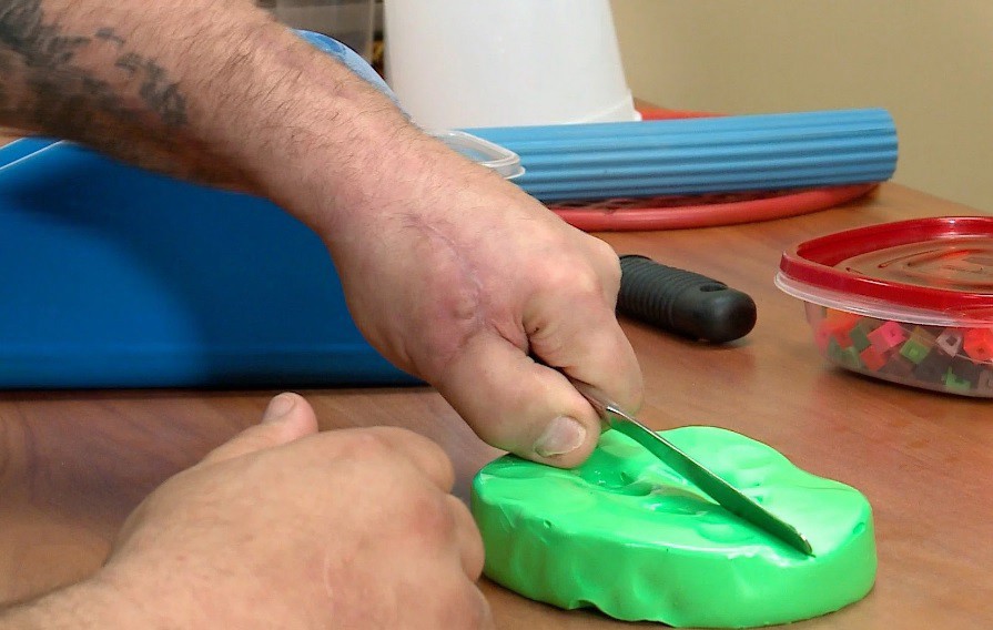 Se cortó un dedo de la mano y le "trasplantaron" uno de su pie | Internacionales