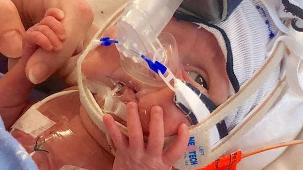 Una madre mostró la increíble recuperación de su hija que nació prematura con medio kilo de peso | Internacionales