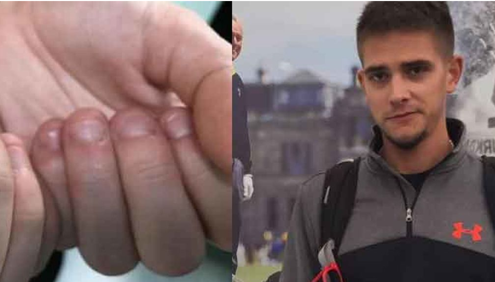 Un joven de 28 años casi muere por morderse las uñas | Internacionales