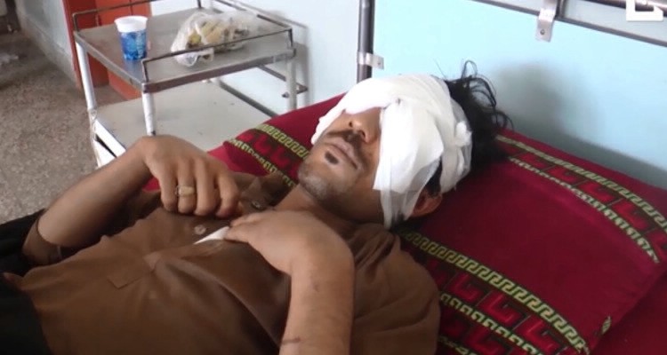 Pakistán: su familia le sacó los ojos con una cuchara porque intentó casarse con su novia sin autorización | Internacionales