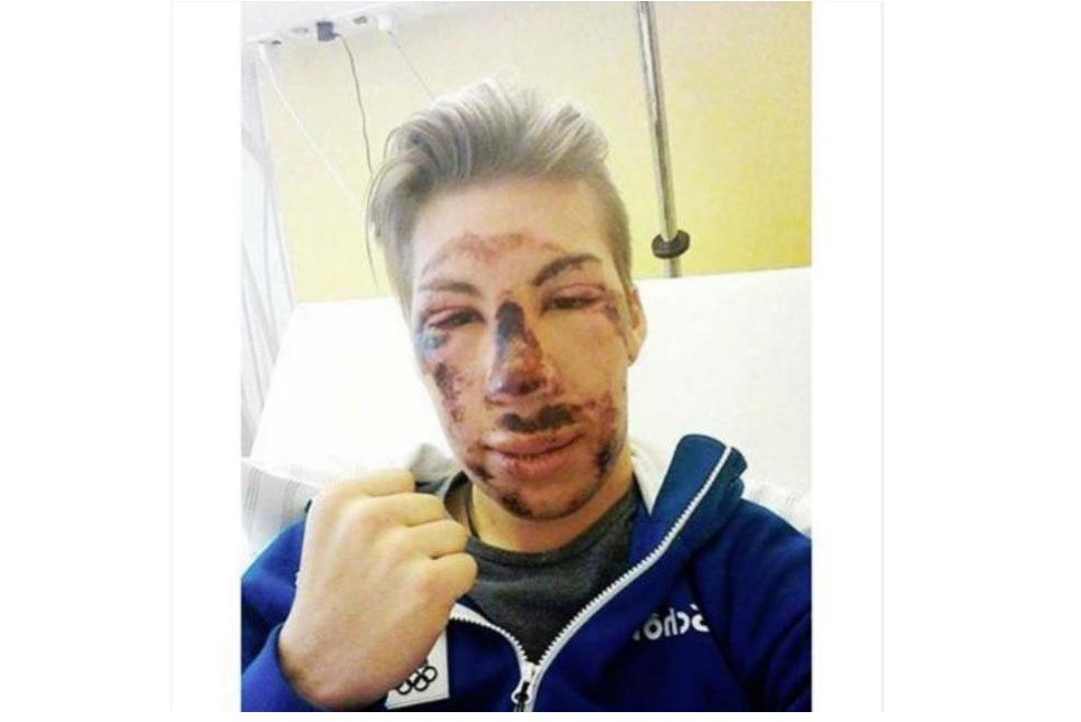 La broma de un esquiador que sufrió un duro accidente | Redes