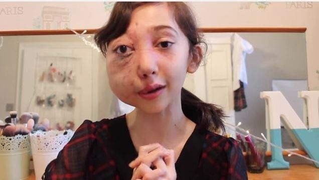 Una youtuber de 21 años vive como un bebé para superar los abusos que sufrió de niña | Redes