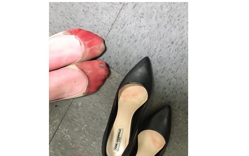 Denunció por Facebook que una empresa obliga a usar tacones aunque destrocen los pies | Redes