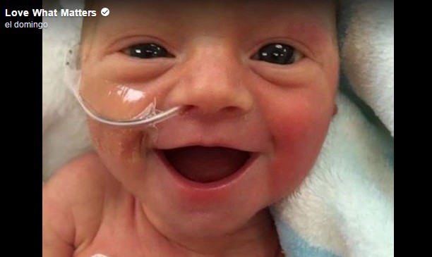 La tierna sonrisa de esta bebé prematura que derrite a las redes sociales | Redes
