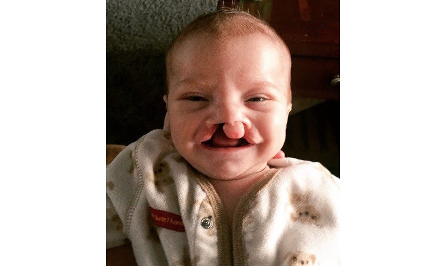 Donante anónimo pagó la operación para un bebé con labio leporino porque se reían de él en internet | Redes