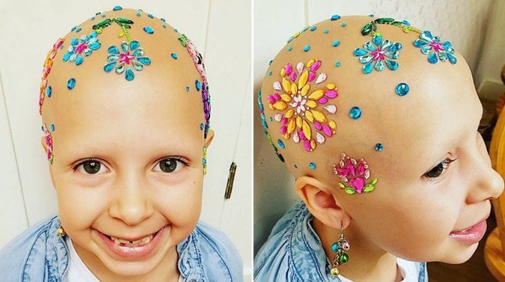 La valentía de esta niña con alopecia que gana un concurso de "peinados raros" se hizo viral | Redes