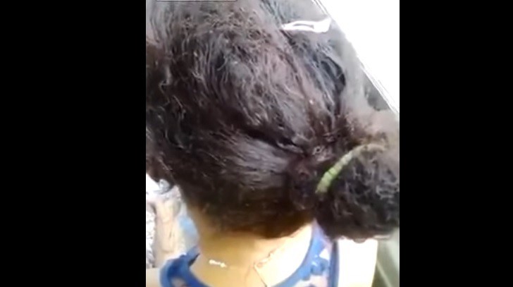 #EsViral El video de la chica con la cabeza llena de piojos que viaja en colectivo en México | Redes