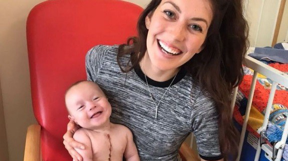 La sonrisa de un bebé tras ser operado a corazón abierto | Redes