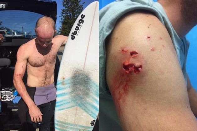 Lo atacó un tiburón mientras surfeaba y se salvó al recordar un video que vio en YouTube | Redes