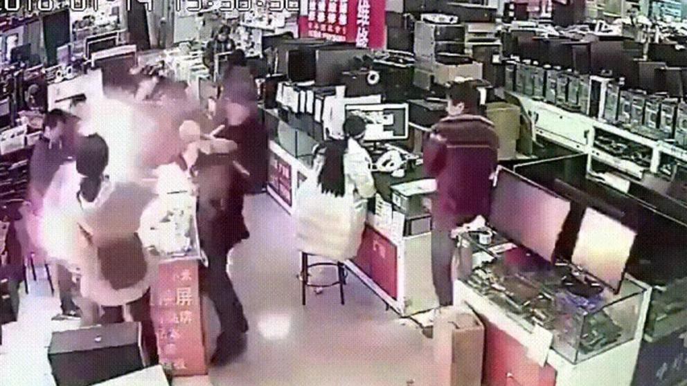 Mordió una batería de Iphone para probarla y le estallo en la cara | Redes