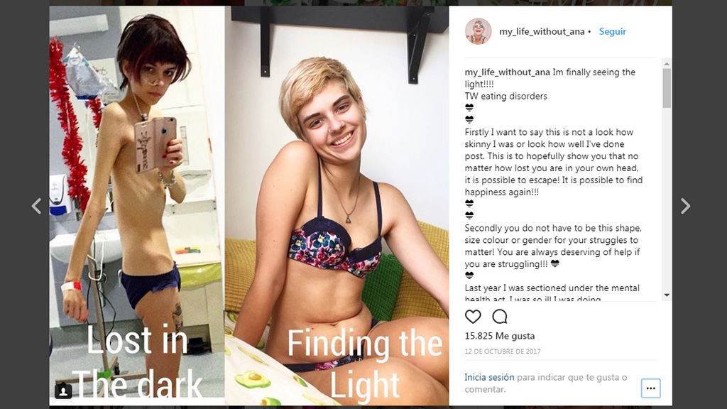 La chica que se curó de la anorexia y ahora difunde información sobre esa enfermedad | Redes