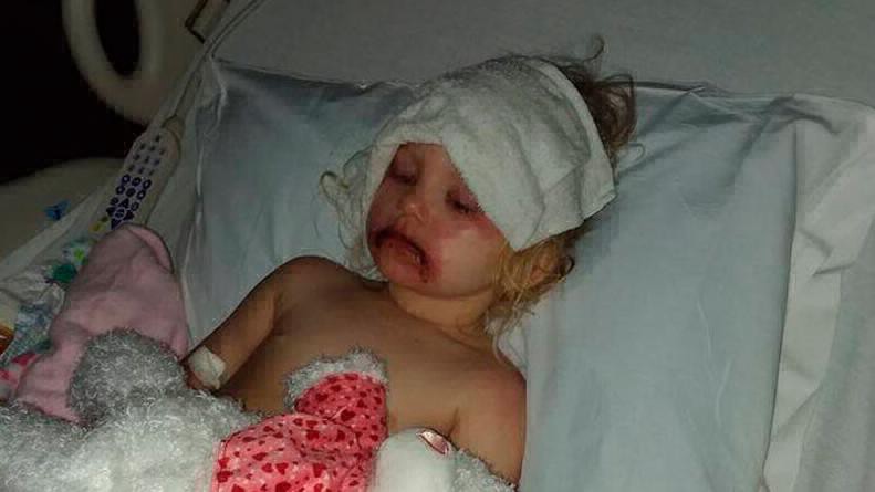 Una nena de tres años tuvo que ser internada después de jugar con el maquillaje que le regaló su madre | Redes