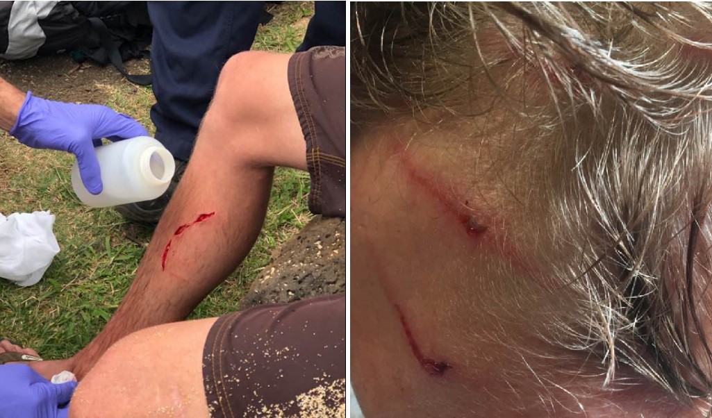 El hombre más odiado por animales: sobrevivió a ataques de tiburón, oso y serpiente | Redes