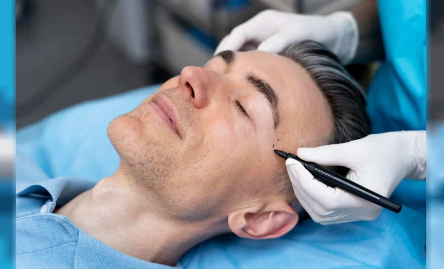 Fallo inédito en Córdoba: ordenan a una prepaga cubrir la totalidad de una cirugía de feminización facial | Actualidad