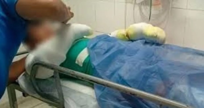 Un adolescente quedó con el 60% del cuerpo quemado tras la explosión de su celular | Actualidad