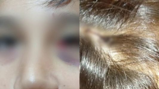 Mar del Plata: apuñalaron a un nene de 13 años con una lapicera