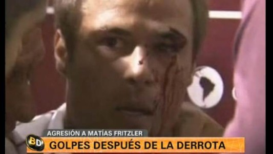 Insólito: un hincha de Lanús le pegó a Frizler en la puerta del vestuario