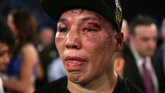 Así quedó el rival de Lucas Matthysse tras la terrible pelea