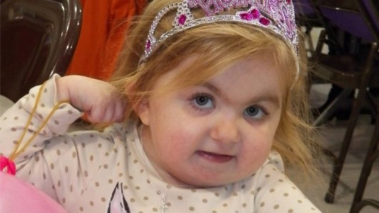 Audrey, la pequeña que lucha contra una rara enfermedad y que conmueve a las redes sociales