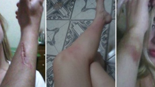 Una modelo denunció en Facebook a su ex novio por golpes y amenazas de muerte