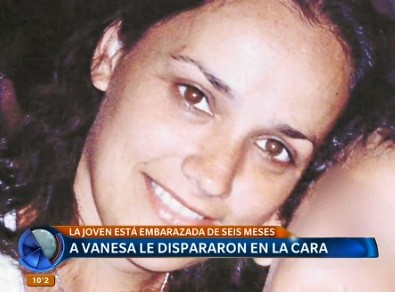 A Vanesa la balearon en la cara