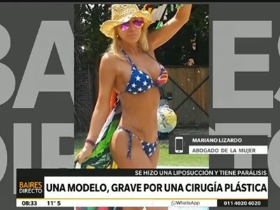 Una modelo, grave por una cirugía plástica
