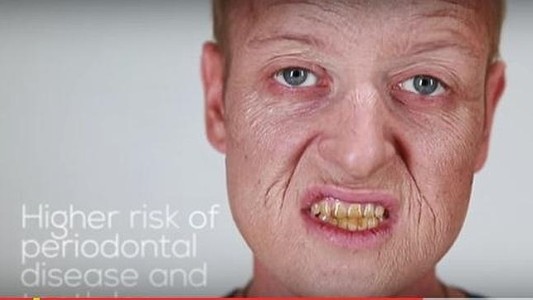 Video impactante: los efectos del cigarrillo sobre el cuerpo de los fumadores