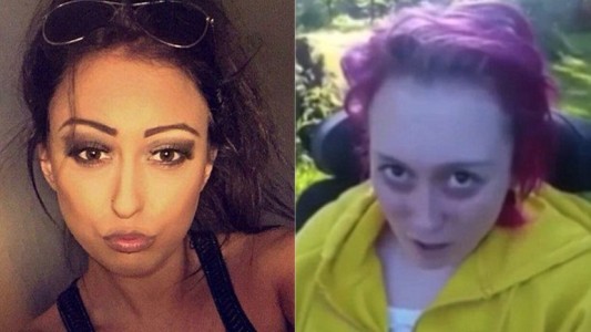 Fotos: el antes y después de una sobredosis de éxtasis