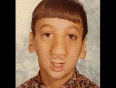 Lo abandonaron al nacer por estar desfigurado y encontró a su madre 40 años después